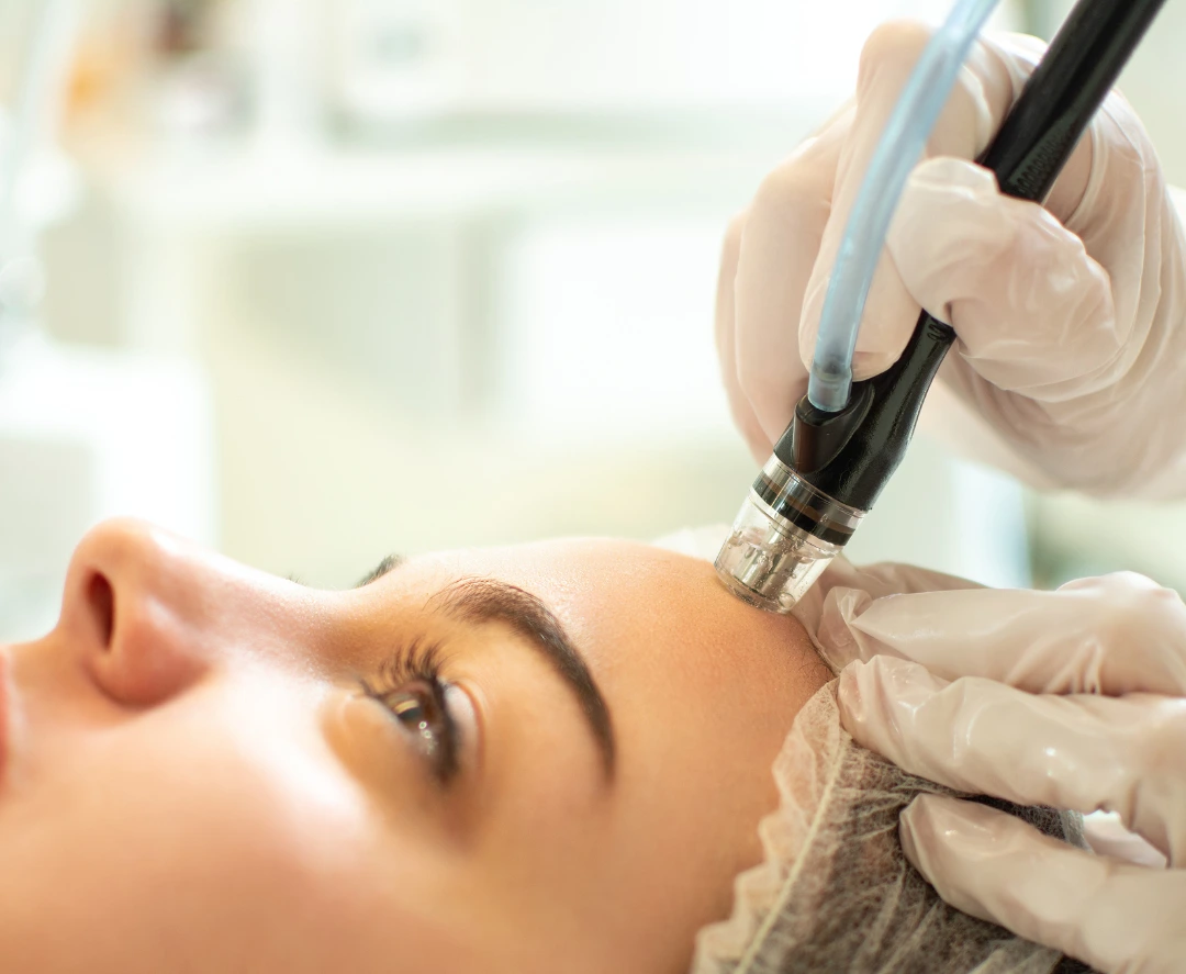 vathis katharismos vs hydrafacial